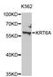 Keratin 6A antibody, STJ24361, St John