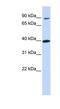 Olfactory Receptor Family 11 Subfamily H Member 12 antibody, NBP1-70664, Novus Biologicals, Western Blot image 