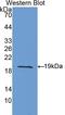 Interleukin 1 Receptor Antagonist antibody, LS-C301556, Lifespan Biosciences, Western Blot image 