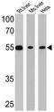 Nuclear Receptor Subfamily 1 Group H Member 2 antibody, GTX82863, GeneTex, Western Blot image 