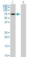 Zinc Finger Protein 449 antibody, H00203523-B01P, Novus Biologicals, Western Blot image 