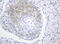 Fibroblast Growth Factor Receptor 3 antibody, M00200-2, Boster Biological Technology, Immunohistochemistry paraffin image 