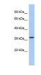 Fibroblast Growth Factor 13 antibody, NBP1-59303, Novus Biologicals, Western Blot image 