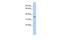 Pyruvate Dehydrogenase E1 Beta Subunit antibody, GTX46256, GeneTex, Western Blot image 