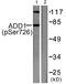 SRBP1 antibody, PA5-38064, Invitrogen Antibodies, Western Blot image 