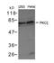 Protein Kinase C Zeta antibody, A01796, Boster Biological Technology, Western Blot image 