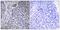 Heterogeneous Nuclear Ribonucleoprotein D Like antibody, A30119, Boster Biological Technology, Immunohistochemistry paraffin image 