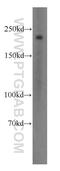 Myosin Heavy Chain 11 antibody, 18569-1-AP, Proteintech Group, Western Blot image 