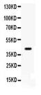 Cyclin Dependent Kinase 9 antibody, PB9537, Boster Biological Technology, Western Blot image 