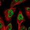 Histone Deacetylase 6 antibody, HPA026321, Atlas Antibodies, Immunofluorescence image 