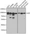 Ezrin antibody, 13-256, ProSci, Western Blot image 