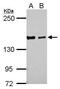 DAZ Interacting Zinc Finger Protein 3 antibody, PA5-32189, Invitrogen Antibodies, Western Blot image 