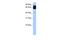 Tetratricopeptide Repeat Domain 12 antibody, PA5-44109, Invitrogen Antibodies, Western Blot image 