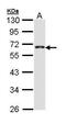CDP-Diacylglycerol Synthase 1 antibody, PA5-29519, Invitrogen Antibodies, Western Blot image 