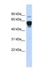 Nuclear Receptor Subfamily 4 Group A Member 2 antibody, orb330014, Biorbyt, Western Blot image 