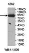 Signal Transducer And Activator Of Transcription 5A antibody, orb78314, Biorbyt, Western Blot image 