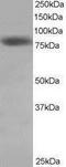 NDC80 Kinetochore Complex Component antibody, PA1-26543, Invitrogen Antibodies, Western Blot image 