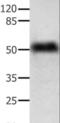 Actin Gamma 1 antibody, LS-C403710, Lifespan Biosciences, Western Blot image 