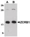 Zinc Finger CCHC-Type And RNA Binding Motif Containing 1 antibody, PA5-20772, Invitrogen Antibodies, Western Blot image 
