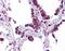 Surfactant Protein C antibody, NBP1-60117, Novus Biologicals, Immunohistochemistry paraffin image 