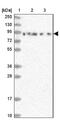 DEAD-Box Helicase 51 antibody, NBP1-85859, Novus Biologicals, Western Blot image 