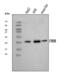 Cytochrome B5 Type B antibody, A09841-1, Boster Biological Technology, Western Blot image 