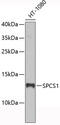 Signal Peptidase Complex Subunit 1 antibody, 19-438, ProSci, Western Blot image 