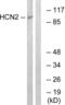 Hyperpolarization Activated Cyclic Nucleotide Gated Potassium And Sodium Channel 2 antibody, LS-C120240, Lifespan Biosciences, Western Blot image 