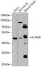 Actin Related Protein 3B antibody, 23-209, ProSci, Western Blot image 