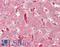 Charged multivesicular body protein 2a antibody, LS-C211715, Lifespan Biosciences, Immunohistochemistry frozen image 