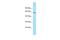 Ankyrin Repeat And FYVE Domain Containing 1 antibody, A10387, Boster Biological Technology, Western Blot image 