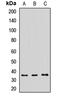 Translocase Of Outer Mitochondrial Membrane 34 antibody, LS-C668257, Lifespan Biosciences, Western Blot image 