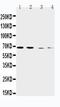 Solute Carrier Family 7 Member 1 antibody, PA2245, Boster Biological Technology, Western Blot image 