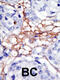 Phosphatidylinositol-5-Phosphate 4-Kinase Type 2 Alpha antibody, 63-360, ProSci, Immunohistochemistry paraffin image 
