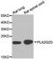 Phospholipase A2 Group IID antibody, A7165, ABclonal Technology, Western Blot image 