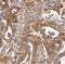 Rho GDP Dissociation Inhibitor Gamma antibody, FNab00557, FineTest, Immunohistochemistry paraffin image 