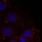 Paxillin antibody, GTX50350, GeneTex, Immunofluorescence image 