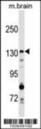 Cyclin G Associated Kinase antibody, 63-372, ProSci, Western Blot image 