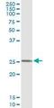 Frataxin antibody, LS-C197243, Lifespan Biosciences, Immunoprecipitation image 