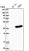 Proenkephalin-A antibody, PA5-53021, Invitrogen Antibodies, Western Blot image 