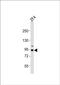 Ribonucleotide Reductase Catalytic Subunit M1 antibody, PA5-72674, Invitrogen Antibodies, Western Blot image 