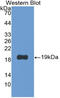 Procollagen C-Endopeptidase Enhancer 2 antibody, LS-C314302, Lifespan Biosciences, Western Blot image 