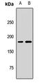 Kinesin Family Member 14 antibody, orb411712, Biorbyt, Western Blot image 