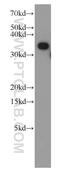 Tetratricopeptide Repeat Domain 1 antibody, 11676-1-AP, Proteintech Group, Western Blot image 