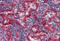 Major Histocompatibility Complex, Class I, E antibody, AM03010BT-N, Origene, Immunohistochemistry paraffin image 