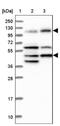 Intraflagellar Transport 122 antibody, NBP1-87014, Novus Biologicals, Western Blot image 