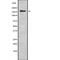 Tensin-1 antibody, PA5-67975, Invitrogen Antibodies, Western Blot image 