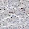 Olfactory Receptor Family 9 Subfamily K Member 2 antibody, HPA015808, Atlas Antibodies, Immunohistochemistry paraffin image 