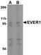 Transmembrane Channel Like 6 antibody, NBP1-76892, Novus Biologicals, Western Blot image 