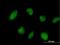 Tripartite Motif Containing 45 antibody, H00080263-B01P, Novus Biologicals, Immunocytochemistry image 